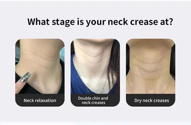 Anti-Wrinkle Anti-Aging Massager Tools For Face For Women