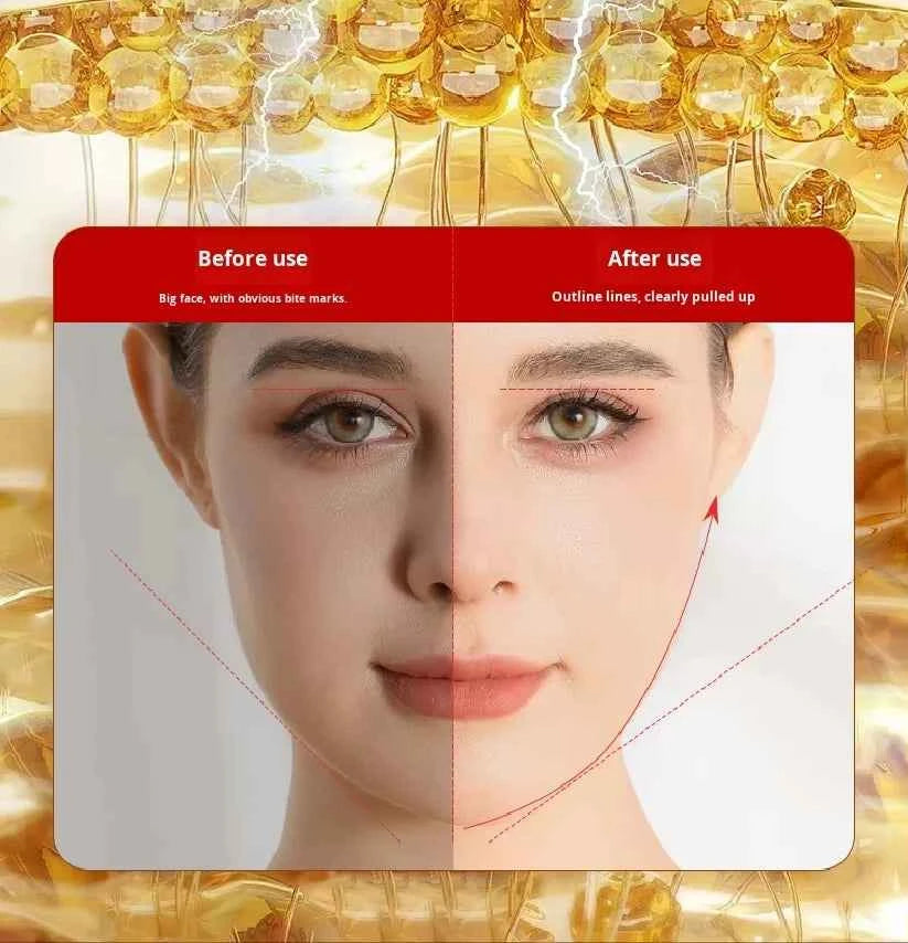 Anti-aging Ems microcurrent roller facial shaping device - V-ray radiofrequency beauty firmening and lifting facial massage